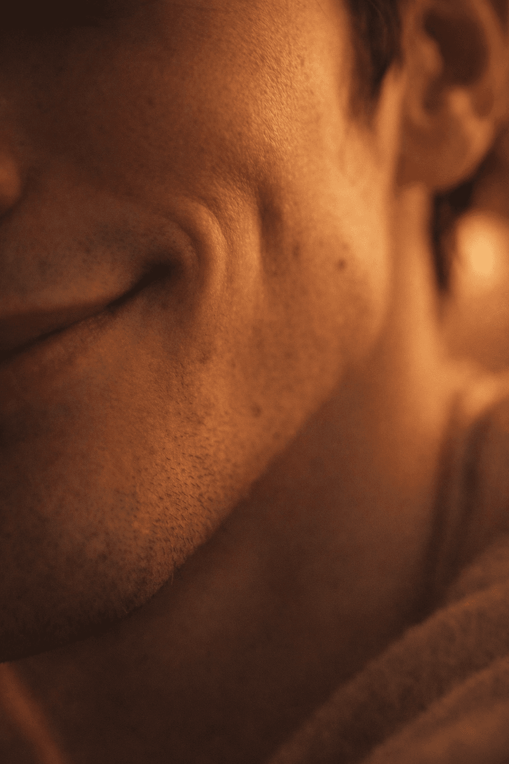 Dimple & laugh lines