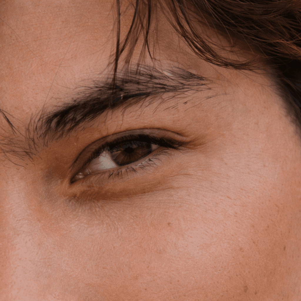 Eyebrow scar